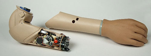 myoelectric-Utah-Arm.jpg